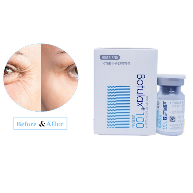 Kroean 100U Toxina Botulínica  Tipo A Rugas Remover BTX