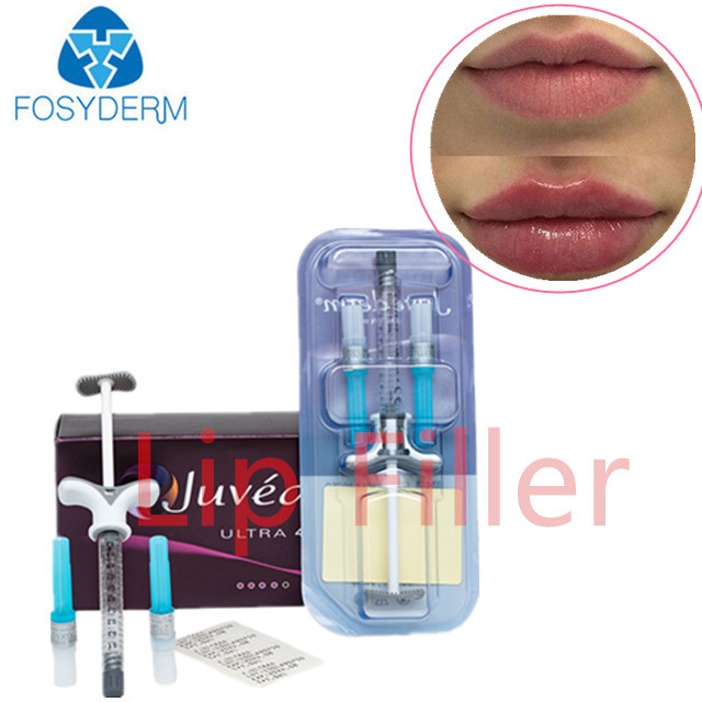 Juvederm Ultra 3 Lips Filler Hyaluronic Acid Filler Dermal para Rosto e Corpo