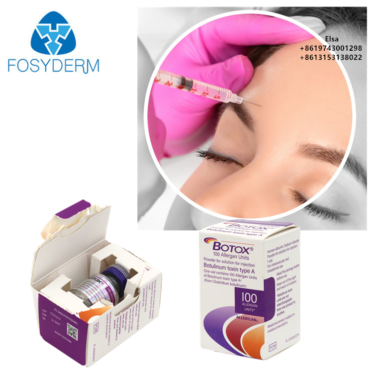 100units Injection Allergan Botulinum Toxin BTX