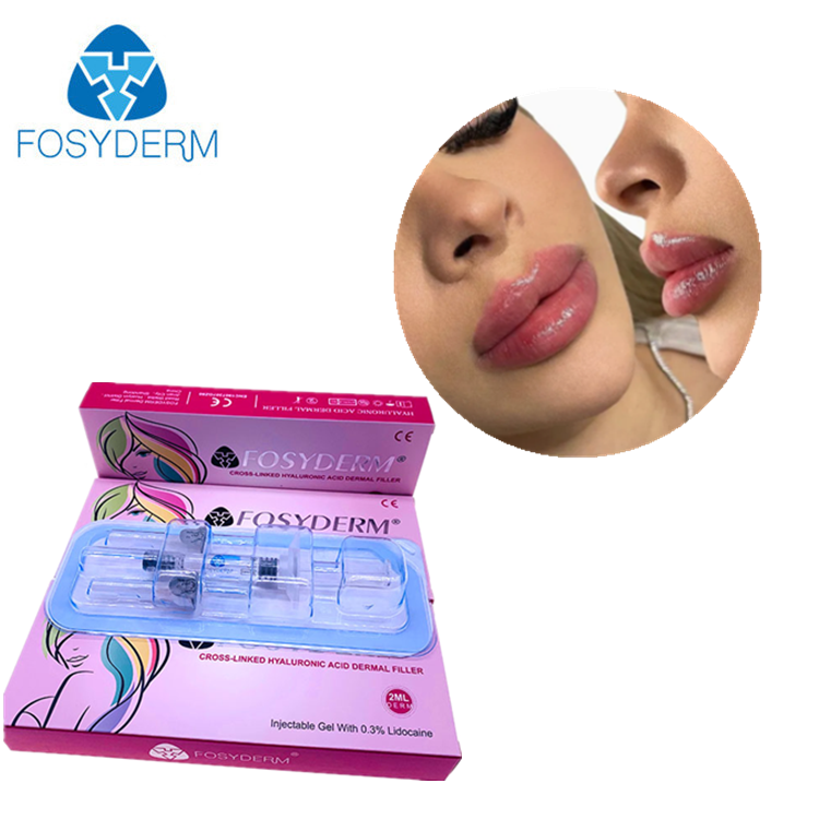Fosyderm Filler Ácido Hialurônico Preenchedor Dérmico Injeção para lábios 2ml