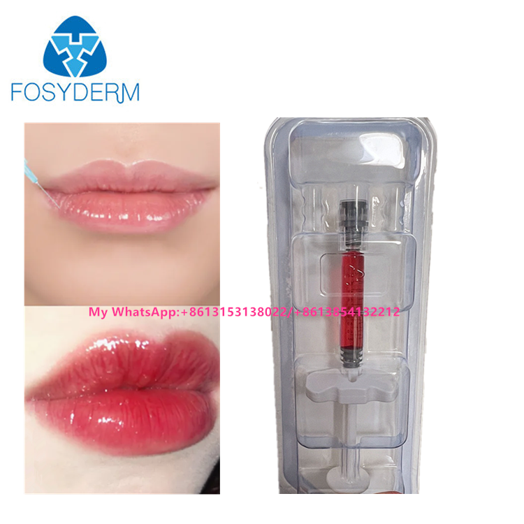 Preenchedor Labial Vermelho Ácido Hialurônico Dermal Filler Injeção Com Vitamina B12 Para Lábios 1ml
