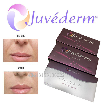 Injeção duradouro ácida hialurónica do enchimento facial Ultra3 Ultra4 Voluma de Juvederm