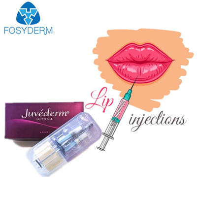 Enchimento ultra 3 cutâneo ácido hialurónico de Juvederm para os bordos da cara