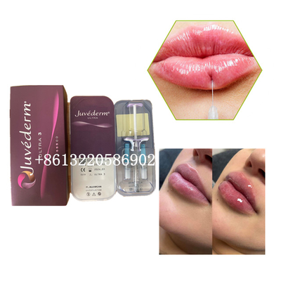 Cutâneo ácido hialurónico da injeção 2ml do enchimento do bordo de Ultra3 Juvederm
