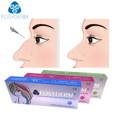 Injeção cutânea ácida hialurónica 1ml 2ml do enchimento do nariz para a utilização fêmea