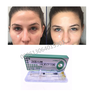 Remova a solução composta de Hyaluronate do sódio escuro dos círculos 1ml
