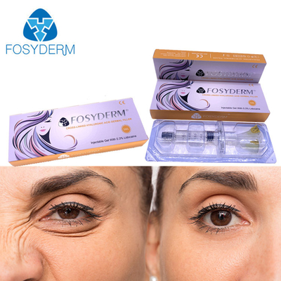 a injeção cutânea ácida hialurónica do enchimento de 5ml Fosyderm para os bordos cheira