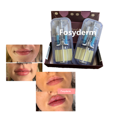 A cruz ácida hialurónica do enchimento dos bordos do volbella de Juvederm ligou 24mg