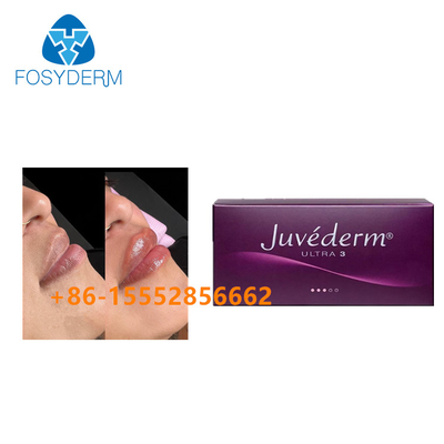 Injeção ácida hialurónica cutânea de Juvederm 2ml do enchimento do realce do bordo