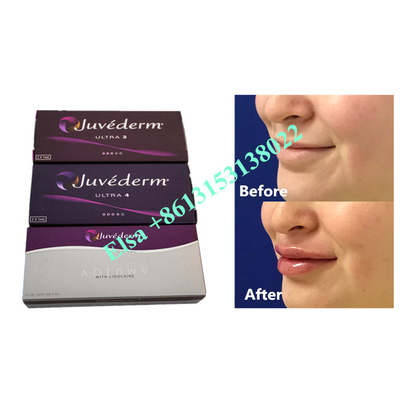 Injeção de preenchimento dérmico de ácido hialurônico Voluma Fosyderm 24mg/mL