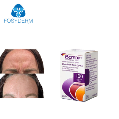 Injeção de 100 Unidades de  De Allergan Anti Rugas