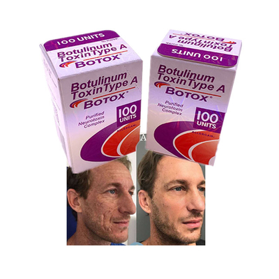 Pó de injeção de  Allergan Cosmetics anti-rugas 100 unidades