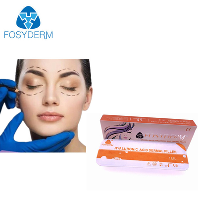 Preenchimento dérmico de ácido hialurônico Fosyderm de longa duração para injeção cosmética