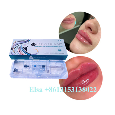 Ce ácido hialurónico 1ml antienvelhecimento 2ml 5ml do enchimento do bordo de Juvederm da injeção do gel