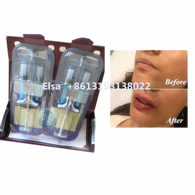 Produto de beleza Juvederm Voluma Ácido hialurónico Enchimento Facial HA Injecção