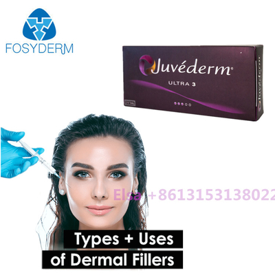 Seringa cutânea de Juvederm dos enchimentos de Voluma/ultra de Juvederm com Lido