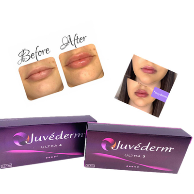 Ce cutâneo ácido hialurónico 2ml antienvelhecimento do enchimento do bordo de Juvederm da injeção do gel