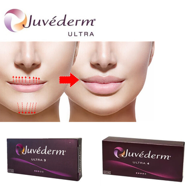 Juvederm Ultra3 Hyaluronic Acid Filler para lábios Gel para injecção cutânea pré-cheio