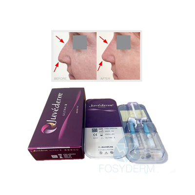 O bordo da cara ligou o gel ácido hialurónico cutâneo de Juvederm Ultra3 do enchimento