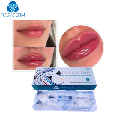 Injeção cutânea ácida hialurónica dos enchimentos dos anti enrugamentos faciais do gel de Fosyderm