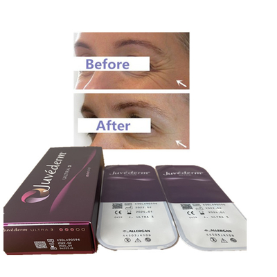 Enchimento cutâneo ácido hialurónico 24mg do bordo do enchimento de Juvederm 2ml Ultra3 Ultra4 Voluma