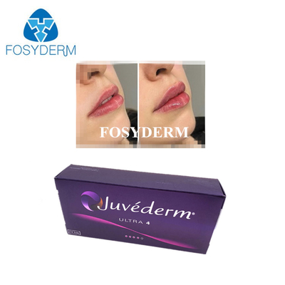 Ácido hialurónico coreano ligado cruzado para preenchimento cutâneo Juvederm Injeções de preenchimento labial