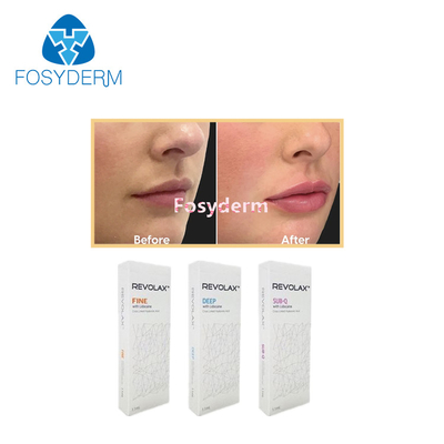 1.1 ml Enchimentos de Lábios Dermicos Revolax Fine Deep Sub-Q para Injecção de Ácido Hyalurónico Anti- Rugas