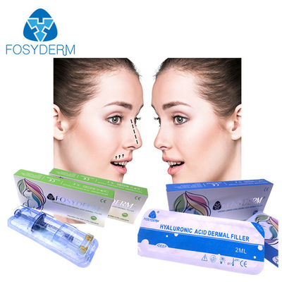 Fosyderm 2 ml Filler dérmico de ácido hialurónico para rugas faciais Lábios queixo Bochechas