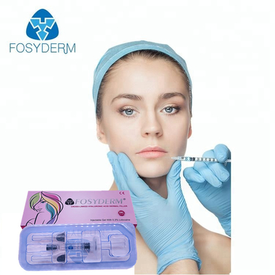 Enchimento dos lábios Aumento da plenitude dos lábios 2 ml Enchimento dérmico Fosyderm HA Injecção de enchimento