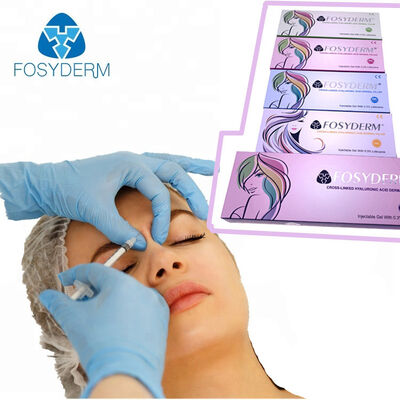 Fosyderm Filler Facial de Ácido Hialurónico Injecção com filler cutâneo