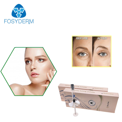 A cruz de Fosyderm ligou o ácido hialurónico da linha tênue do enchimento 2ml do HA para enrugamentos do olho
