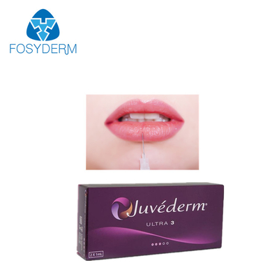 Enchimento ultra 3 2*1ml cutâneo ácido hialurónico de Juvederm do bordo