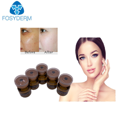 soro de 20mg/ml 5ml Mesotherapy que clarea a solução meso