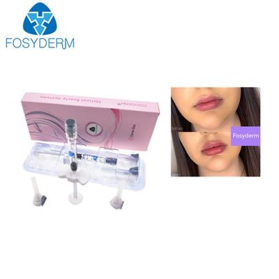 injeção ácida hialurónica do bordo 1ml dos enchimentos cutâneos de 0.28mm HA