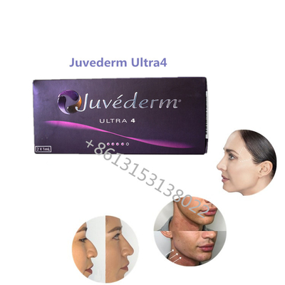 Enchimentos cutâneos de Juvederm HA do enchimento de Juvederm Ultra4 Allergan da plenitude do bordo para os bordos