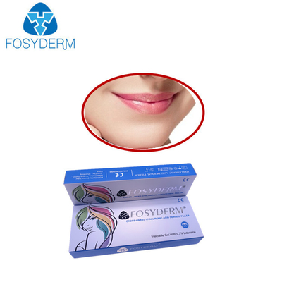 Linhas linha cutânea ácida hialurónica enchimentos cutâneos do sorriso de Derm do volume do enchimento do Lidocaine de Lyft