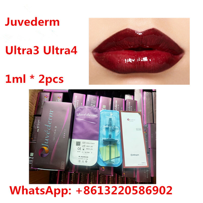 Enchimento cutâneo do HA do bordo de Juvederm com Lidocaine Ultra3 Ultra4