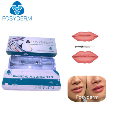 a cruz 1ml ligou o enchimento cutâneo ácido hialurónico para os bordos cheira Chin