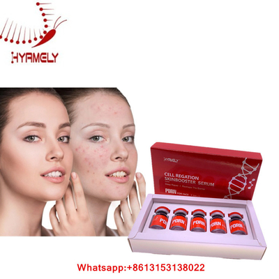 Soro de PDRN para a injeção facial Mesotherapy de Hyamely da regeneração da pele