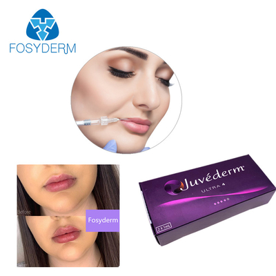 Enchimento cutâneo ácido hialurónico 24mg/Ml do bordo de Juvederm do gel do enchimento de Ultra3 Ultra4 Voluma