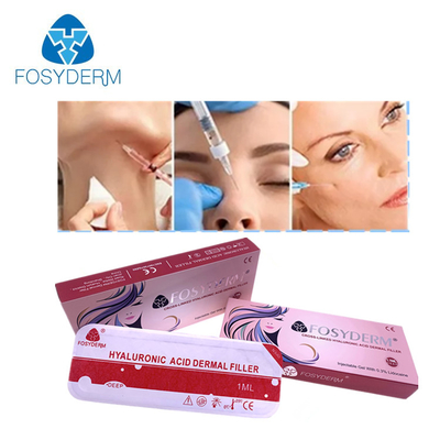 Mordente da suficiência do bordo que levanta o enchimento cutâneo facial Fosyderm injetável 2ml do HA